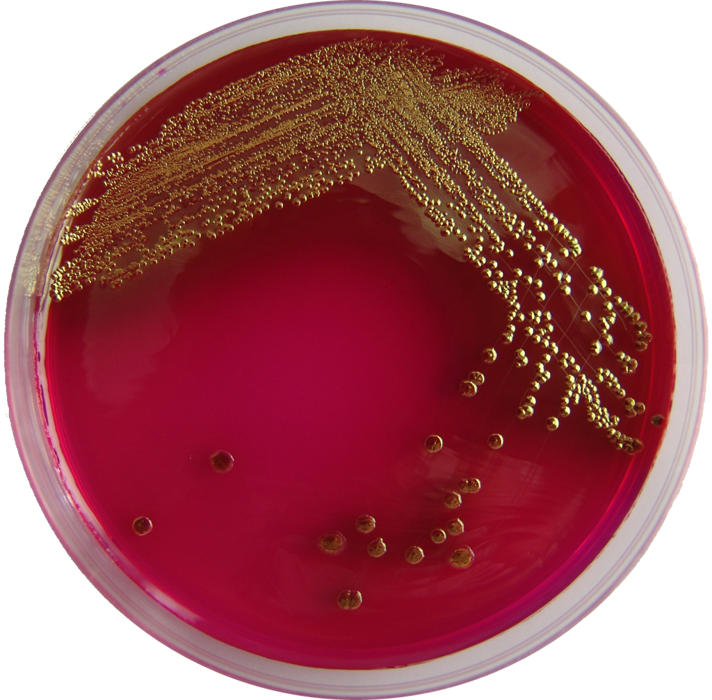placa petri escherichia coli